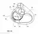 Fig. 17 - Apparatuses and methods for heart valve repair