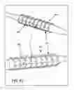Fig. 26 - Apparatuses and methods for heart valve repair