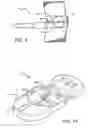 Fig. 08 - Intraocular lens and cartridge packaging with lens-loading function