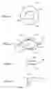 Fig. 02 - Intra-ocular lens