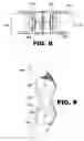 Fig. 06 - System and method for breast augmentation