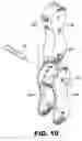 Fig. 07 - System and method for breast augmentation