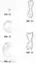 Fig. 09 - System and method for breast augmentation