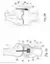 Fig. 04 - Ligament attachment and repair device