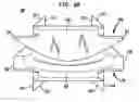 Fig. 07 - Intervertebral disc and insertion methods therefor