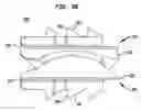 Fig. 08 - Intervertebral disc and insertion methods therefor