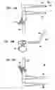 Fig. 17 - Intervertebral disc and insertion methods therefor