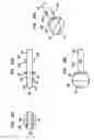 Fig. 23 - Intervertebral disc and insertion methods therefor