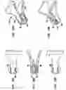 Fig. 27 - Intervertebral disc and insertion methods therefor