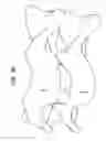 Fig. 36 - Intervertebral disc and insertion methods therefor