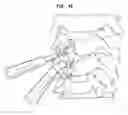 Fig. 40 - Intervertebral disc and insertion methods therefor