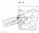 Fig. 44 - Intervertebral disc and insertion methods therefor