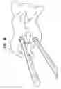 Fig. 50 - Intervertebral disc and insertion methods therefor