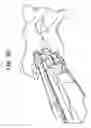 Fig. 51 - Intervertebral disc and insertion methods therefor