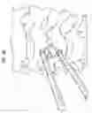 Fig. 54 - Intervertebral disc and insertion methods therefor