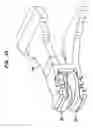 Fig. 59 - Intervertebral disc and insertion methods therefor