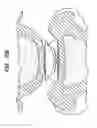 Fig. 70 - Intervertebral disc and insertion methods therefor