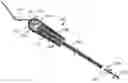 Fig. 01 - Tapered anchor for tendon graft