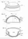 Fig. 02 - Foldable prosthetic implant element