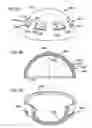 Fig. 03 - Foldable prosthetic implant element