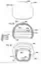 Fig. 07 - Foldable prosthetic implant element