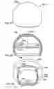 Fig. 10 - Foldable prosthetic implant element