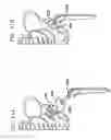 Fig. 12 - Foldable prosthetic implant element