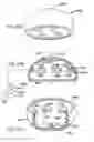 Fig. 22 - Foldable prosthetic implant element
