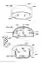 Fig. 23 - Foldable prosthetic implant element