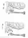 Fig. 27 - Foldable prosthetic implant element