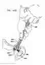 Fig. 46 - Foldable prosthetic implant element