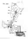 Fig. 48 - Foldable prosthetic implant element