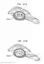Fig. 52 - Foldable prosthetic implant element