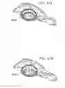 Fig. 53 - Foldable prosthetic implant element