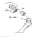 Fig. 55 - Foldable prosthetic implant element