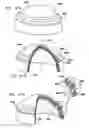 Fig. 65 - Foldable prosthetic implant element
