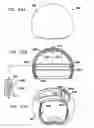 Fig. 72 - Foldable prosthetic implant element