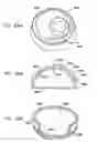 Fig. 84 - Foldable prosthetic implant element