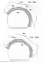 Fig. 87 - Foldable prosthetic implant element