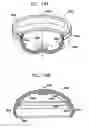 Fig. 92 - Foldable prosthetic implant element