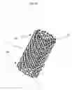 Fig. 02 - Internally Placed Gastric Restriction Device