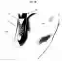 Fig. 07 - Internally Placed Gastric Restriction Device