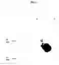 Fig. 03 - Expression of the human igf-1 in transgenic plastids