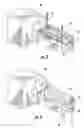 Fig. 03 - Patient single surface system