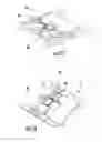 Fig. 12 - Patient single surface system