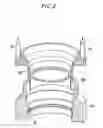 Fig. 03 - System for mounting a snap ring