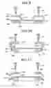Fig. 11 - Method of producing a probe with a trapezoidal contactor