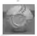 Fig. 05 - Autograph ball