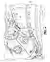 Fig. 05 - Gas turbine engine auxiliary component mount