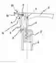 Fig. 01 - Movement-assisted corkscrew